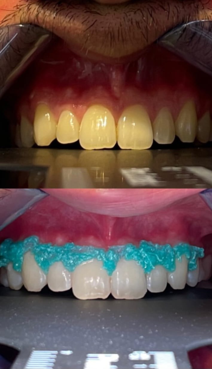 Alanyada Diş Kliniği | KARACA DENTAL CLINIC